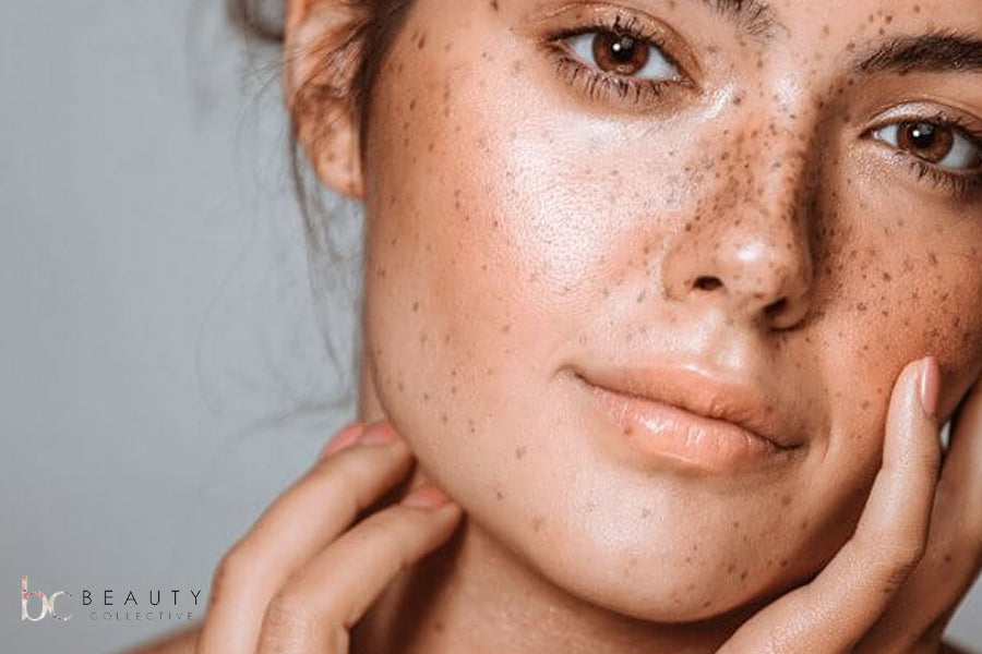 Beauty Collective - Hyperpigmentation