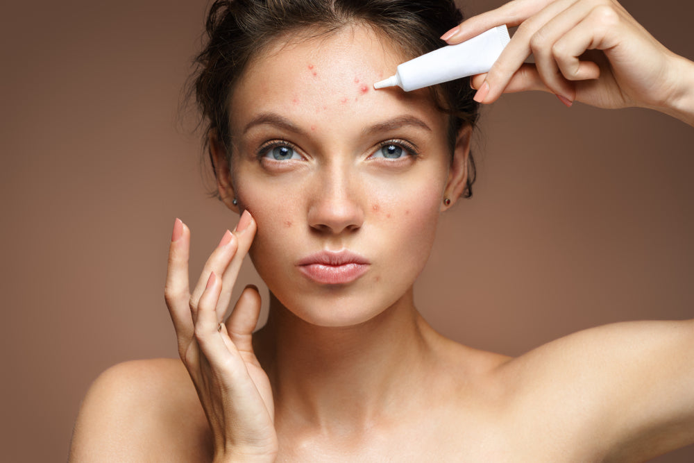 Clear skin? 10 steps to reduce acne